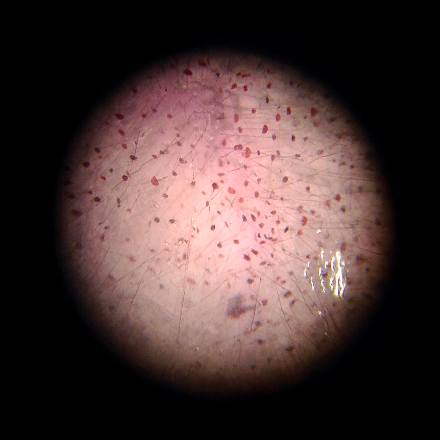 A strawberry quartz stone under high power magnification. Lepidocrocite needle inclusions are seen.